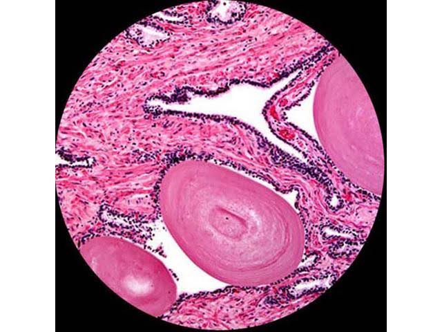 40X-2000X LED Trinocular Compound Microscope I4921